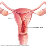 Illustration of the cervix