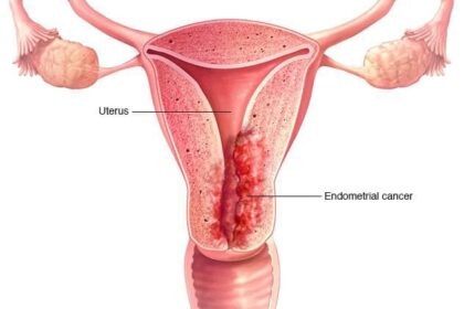 Illustration of the cervix