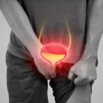 Urinary retention
