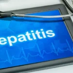 Hepatitis