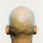 Shouts BaldManifesto