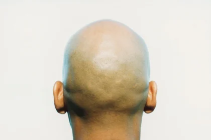 Shouts BaldManifesto