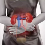 0920UTIs in womenCH.jpg