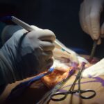 plastic surgery in abuja nigeria liposuction in abuja