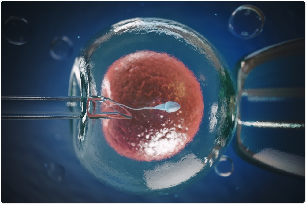 An image used to illustrate the process of IVF. Credit: sourced from web